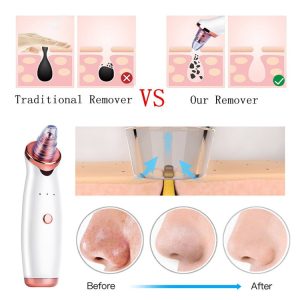 Facial Blackhead Remover Electric Acne Cleaner Blackhead Black Point Vacuum Cleaner Tool Black Spots Pore Cleaner Machine